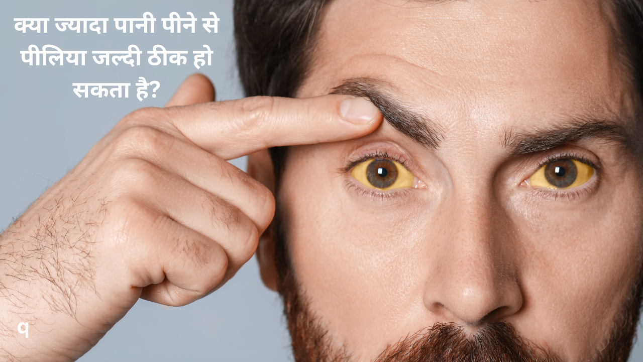 क्या ज्यादा पानी पीने से पीलिया जल्दी ठीक हो सकता है?